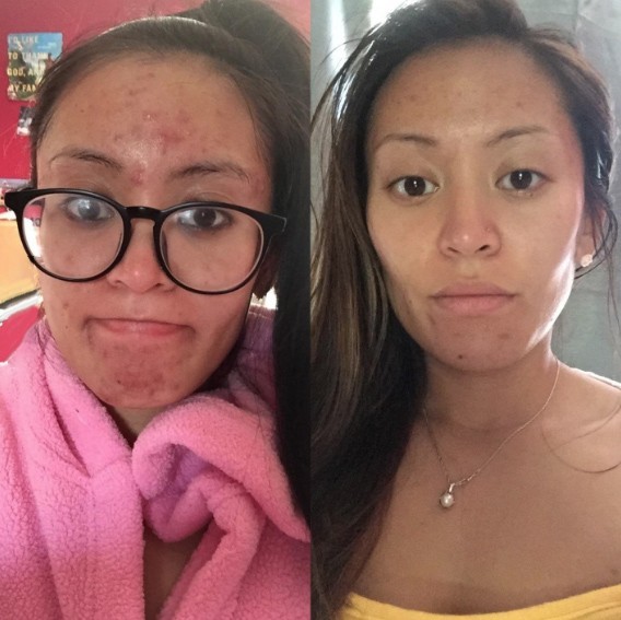 Liver Cleanse Detox & Repair Formula with Premium Milk Thistle - 45 Day Supply