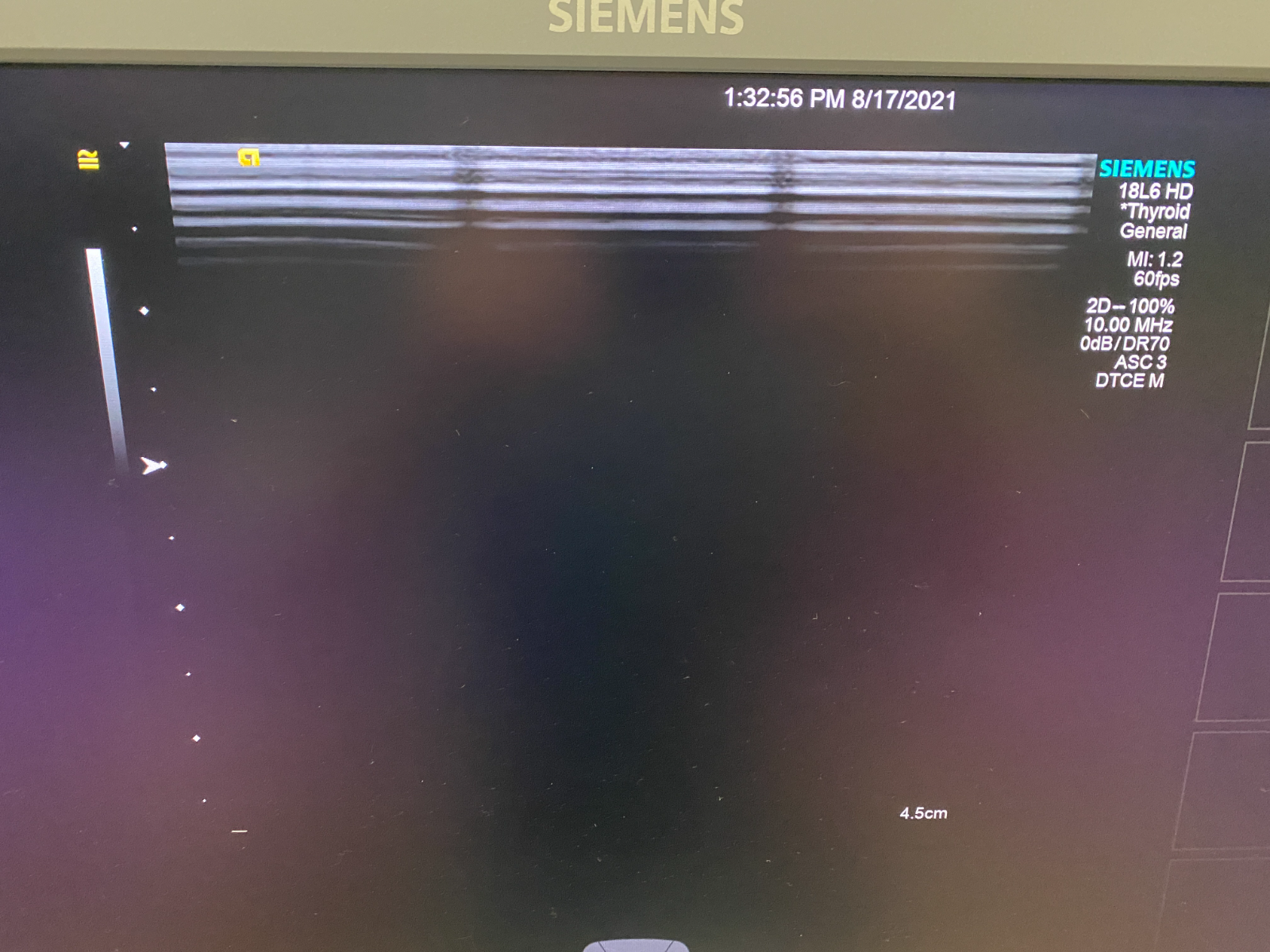 Siemens 18L6 HD Ultrasound Transducer Probe for Acuson S1000 S2000 and S3000