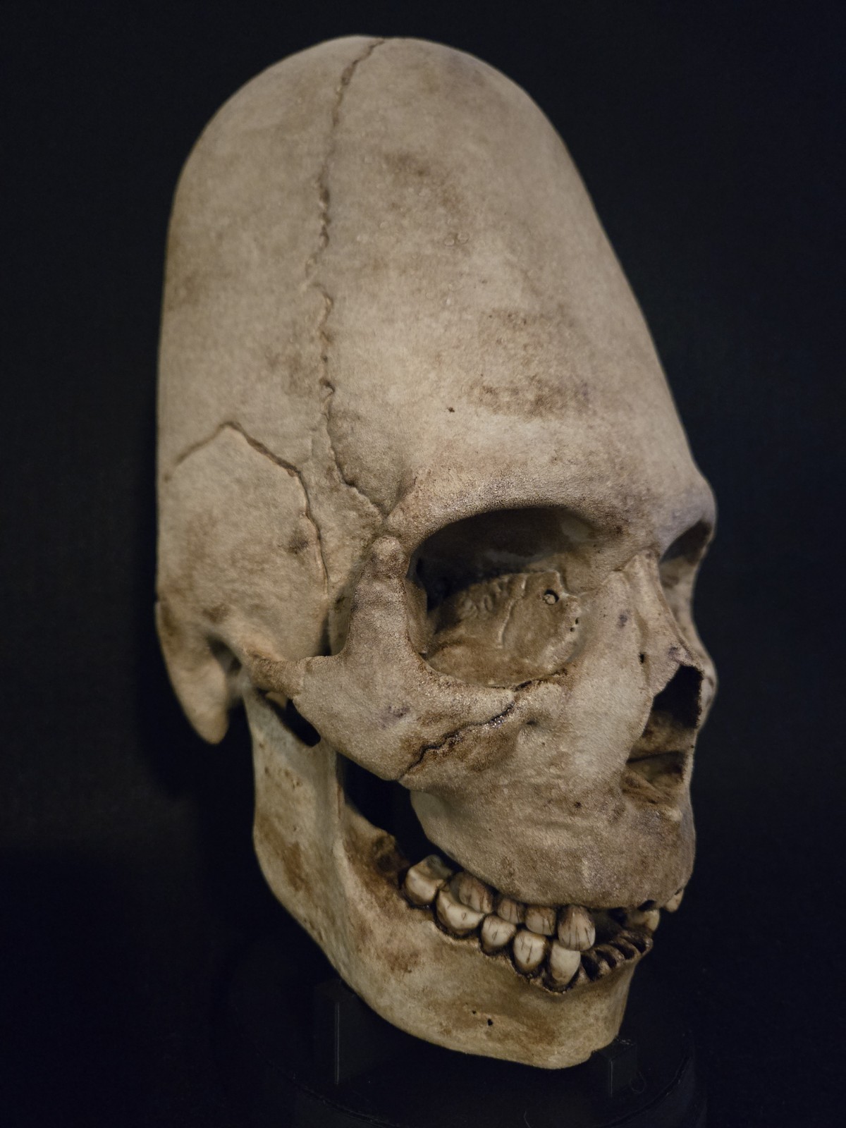 Human Skull - Peruvian Enlongated- Hyper Realistic with stand.