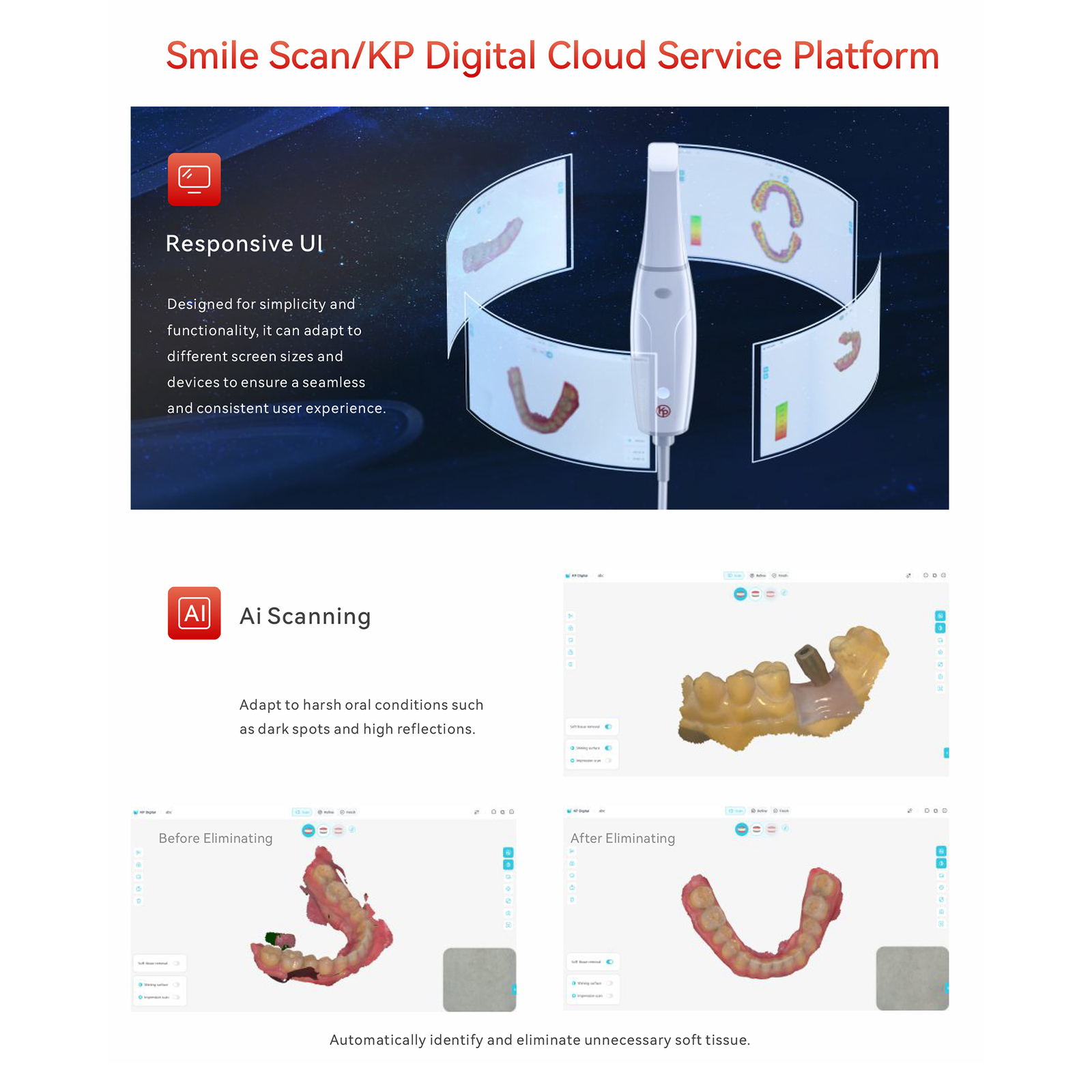 Woodpecker KP Dental Digital 3D Intraoral Scanner Ai Scanning for Dentistry