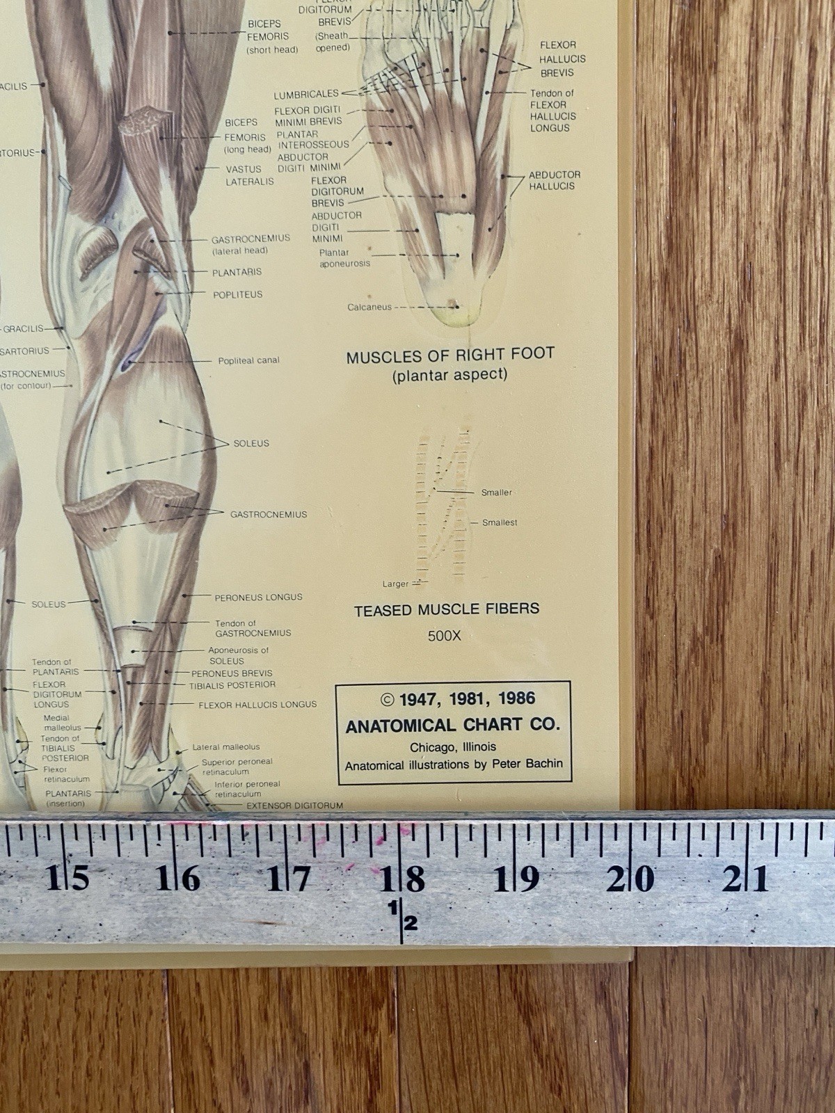 VTG Medical Poster Anatomical Chart Co Muscular Sys Laminated Peter Bachin 24x20
