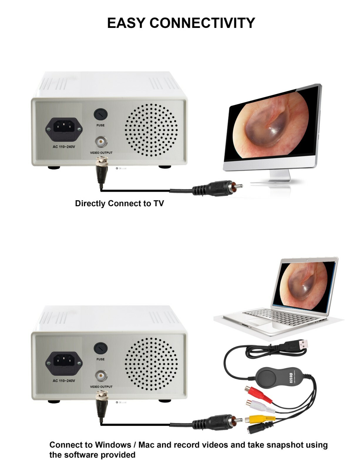 Endoscopy Camera & Cold LED Light Source HD USB ENT Medical Endoscope with fiber