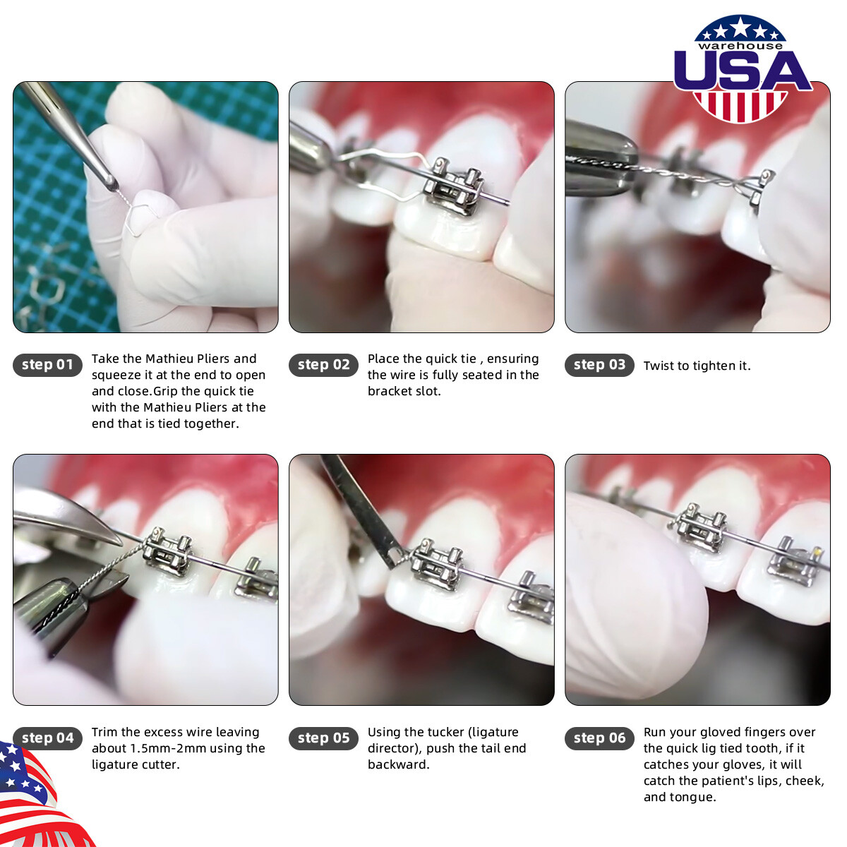Dental Orthodontic Wire Preformed Kobayashi Ligature Ties Long Short Twist Wires