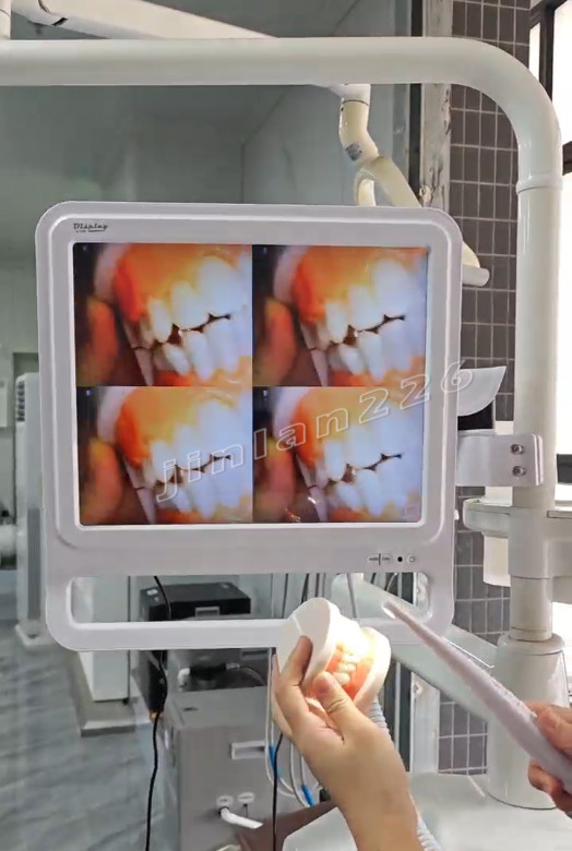 Dental Digital Intraoral Camera with Electric Monitor
