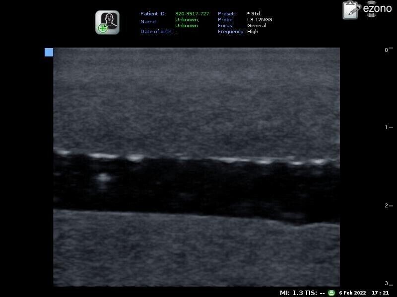 ultrasound phantom training model