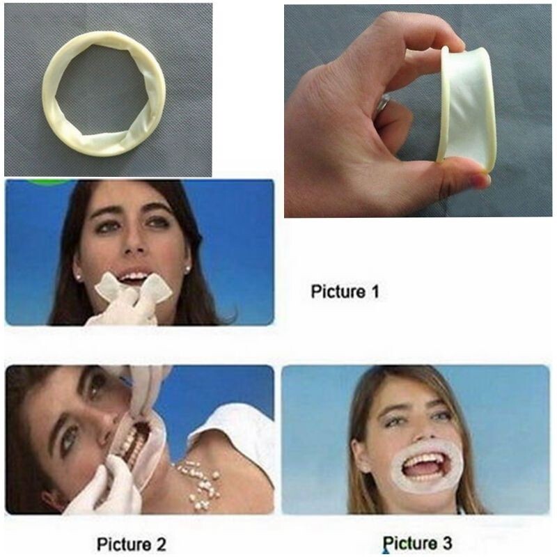 Dental Rubber Dam Mouth Opener Cheek Retractor IVOCLAR VIVADENT Optragate Style