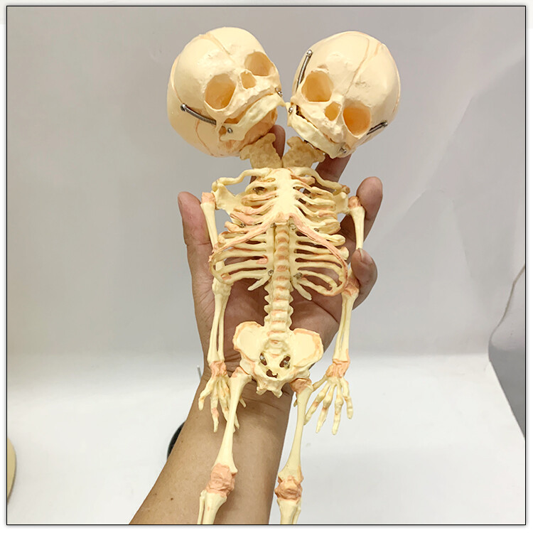 Fetal fetus Skeleton teaching educational Model Double Head Baby Skull Skeleton