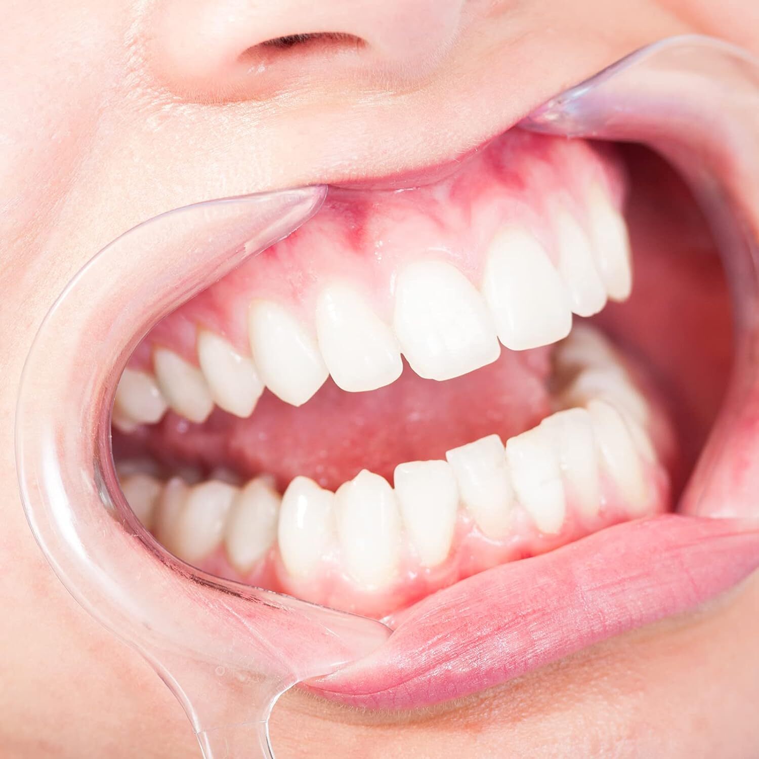 JMU Dental Teeth Whitening Cheek Lip Retractor Mouth Opener Expander S+M+L