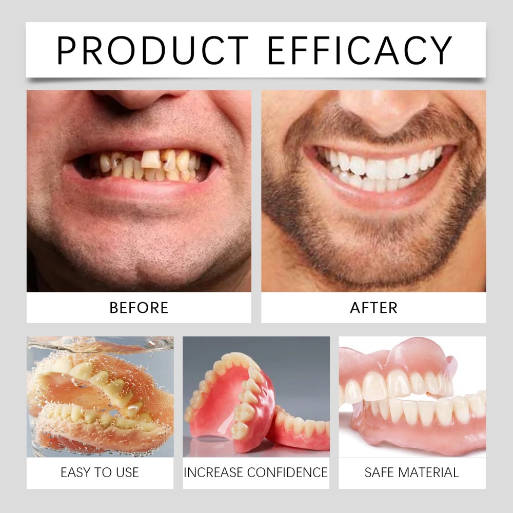 Flexible Silicone Premium Denture - Full Set Top Bottom Teeth For Men And Women