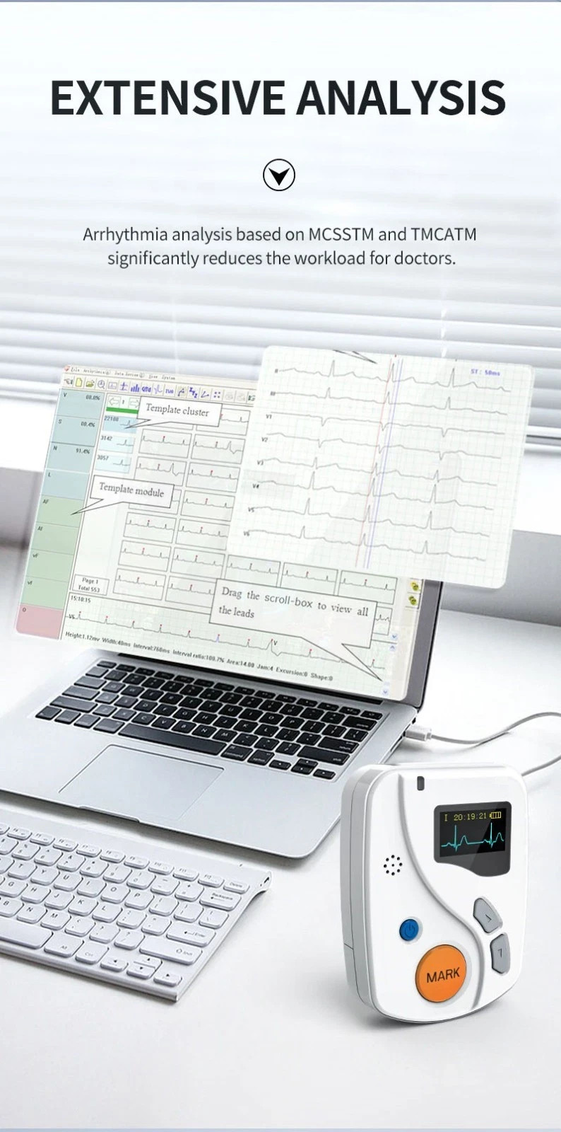 New 12 Channels ECG Holter 48Hour Recorder Dynamic EKG Monitor System TLC6000