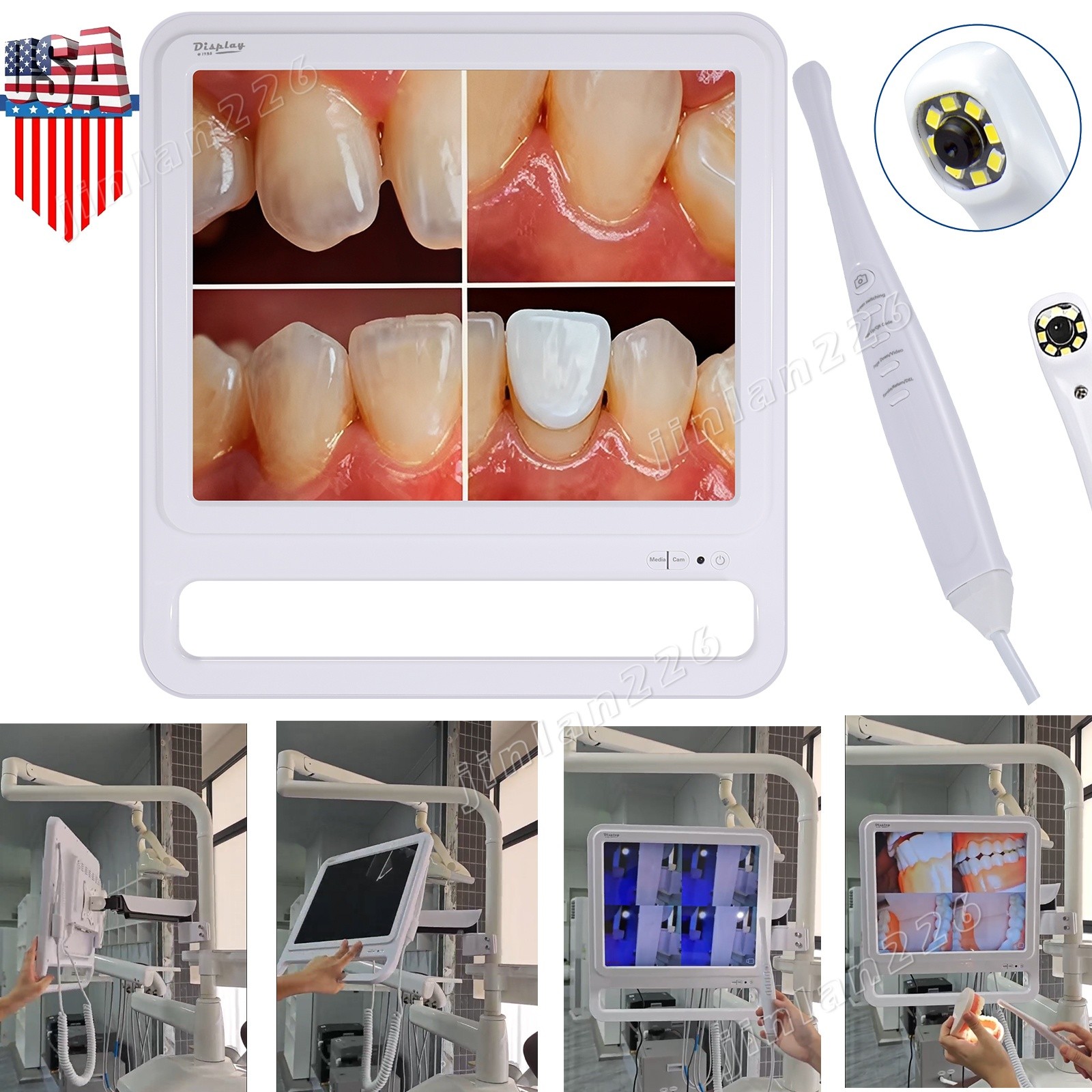 Dent 17" LCD Monitor Dental Intraoral Camera Intra Oral Camera W/Bracket Holder