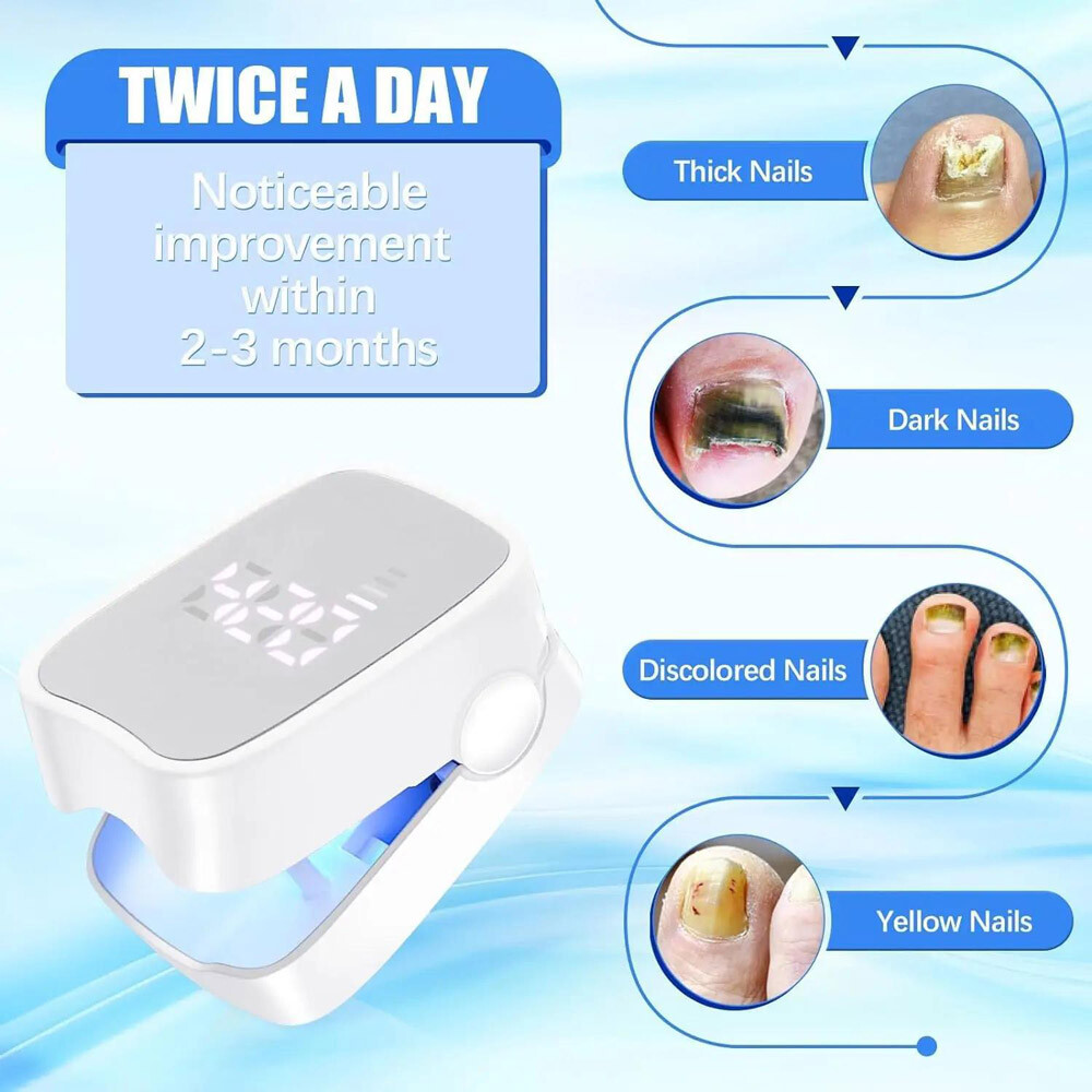Nail Fungus Laser Treatment Device for Multiple Toenail Onychomycosis Remover US