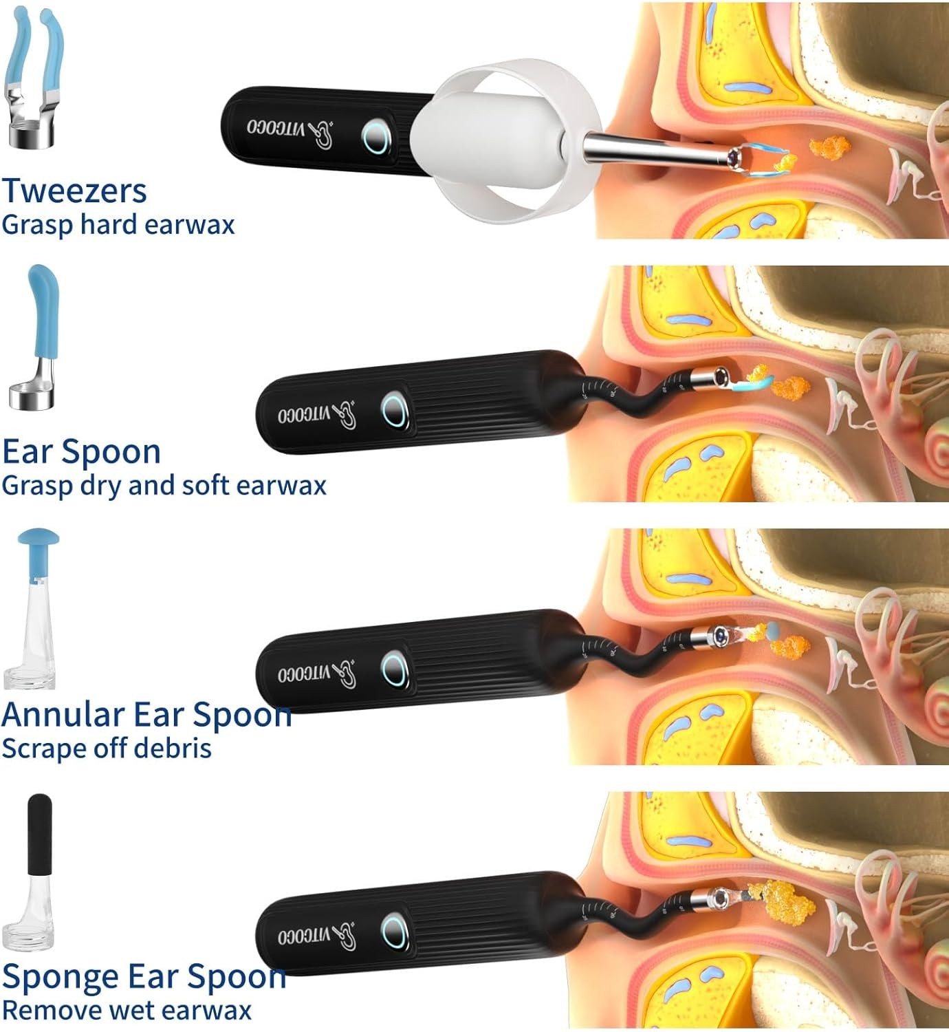 All-in-One Ear Wax Cleaner – 1080P Camera, 3 Tools & Case – for All Ages 1080P