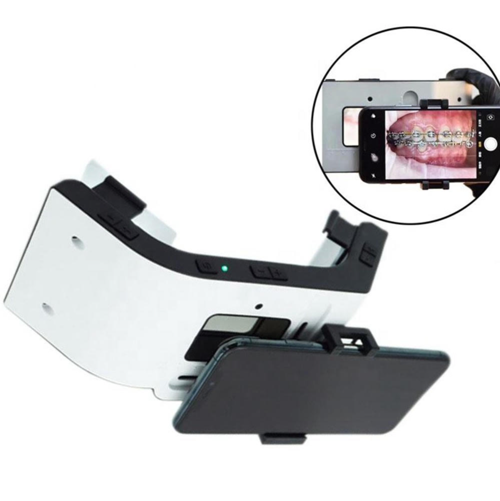 MOBILE DENTAL PHOTOGRAPHY LIGHT DSLR ALTERNATIVE