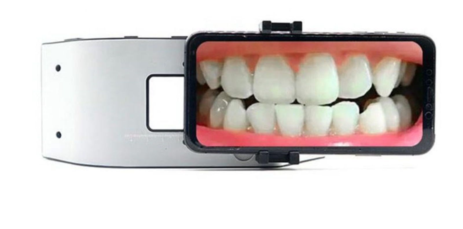 MOBILE DENTAL PHOTOGRAPHY LIGHT DSLR ALTERNATIVE