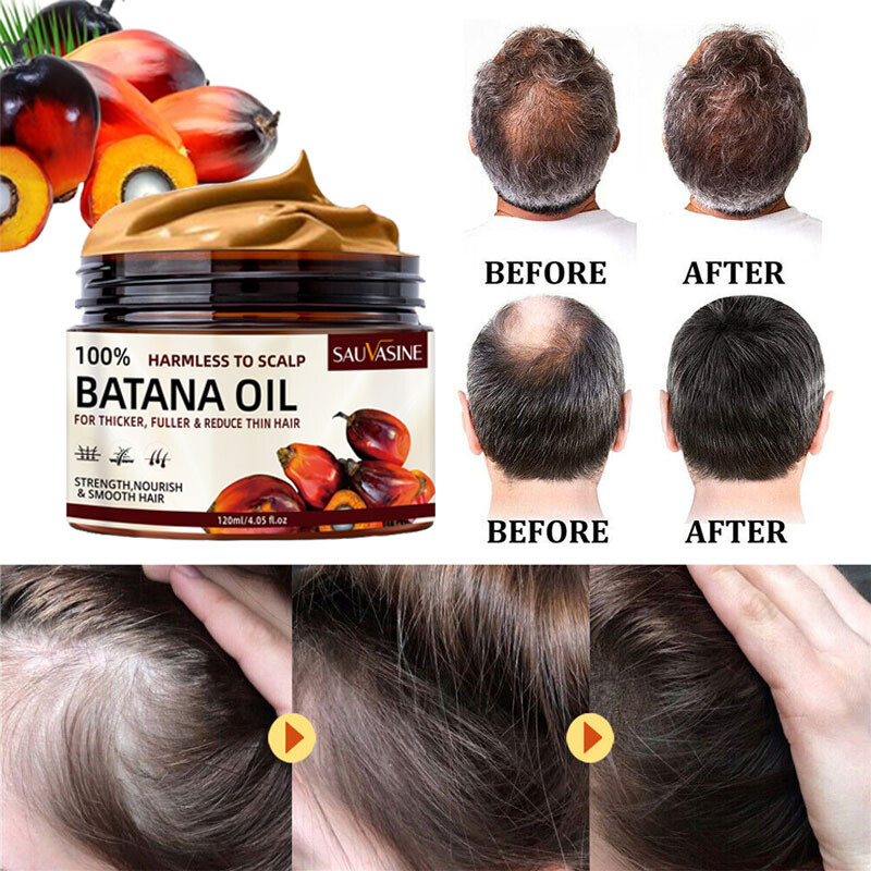 120ml Batana Oil Cream For Hair Growth Healthier Thicker Fuller Anti Hair Loss