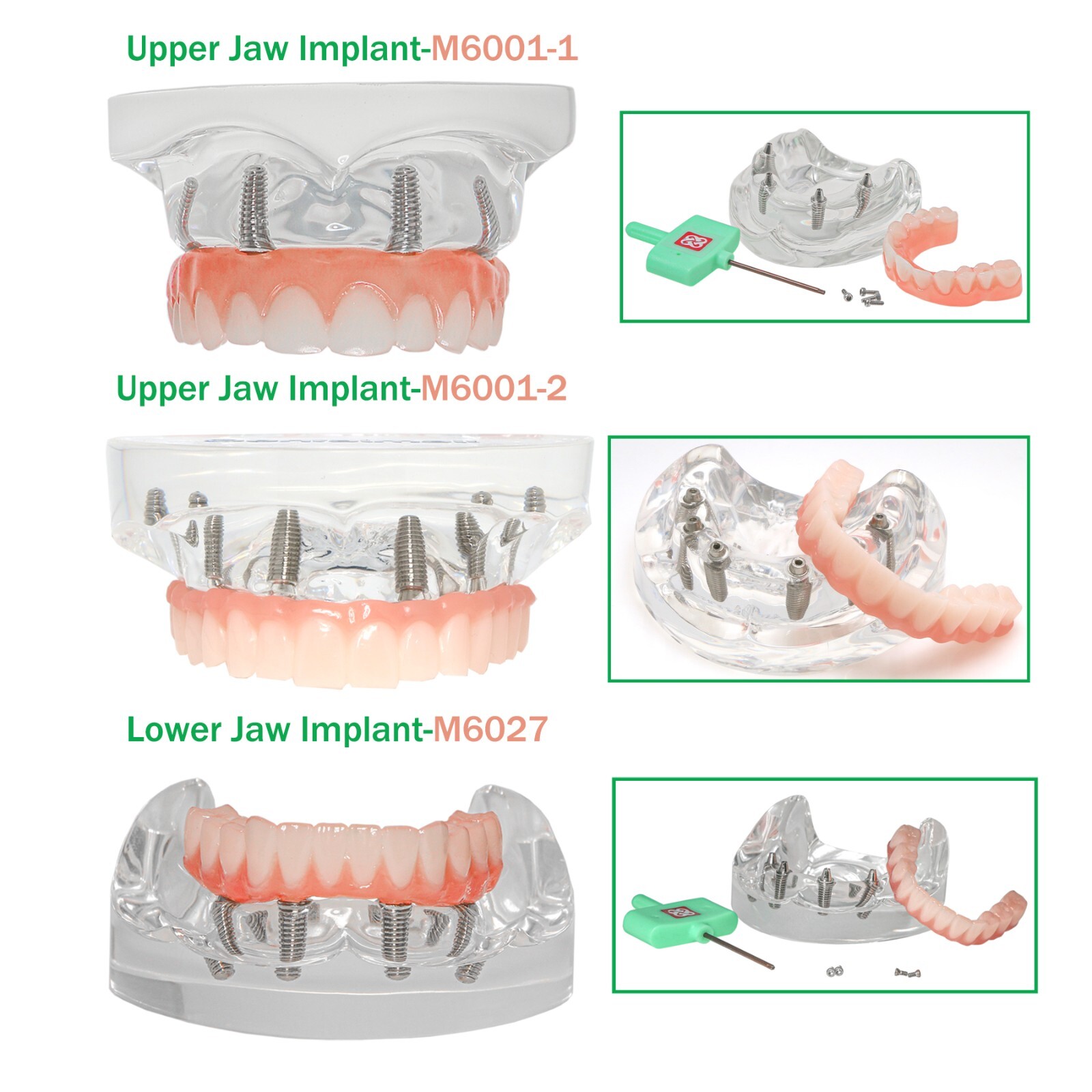 All-on-4/6 Dental Implant Model Upper/Lower Jaw Removable Screws Transparent