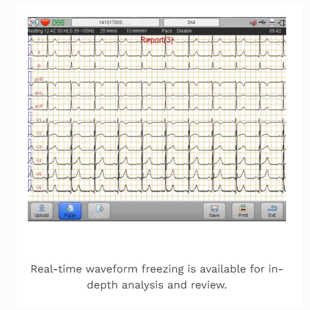 Biocare iE6 12 lead 6 channel ECG Machine Touchscreen with interpretation FDA US