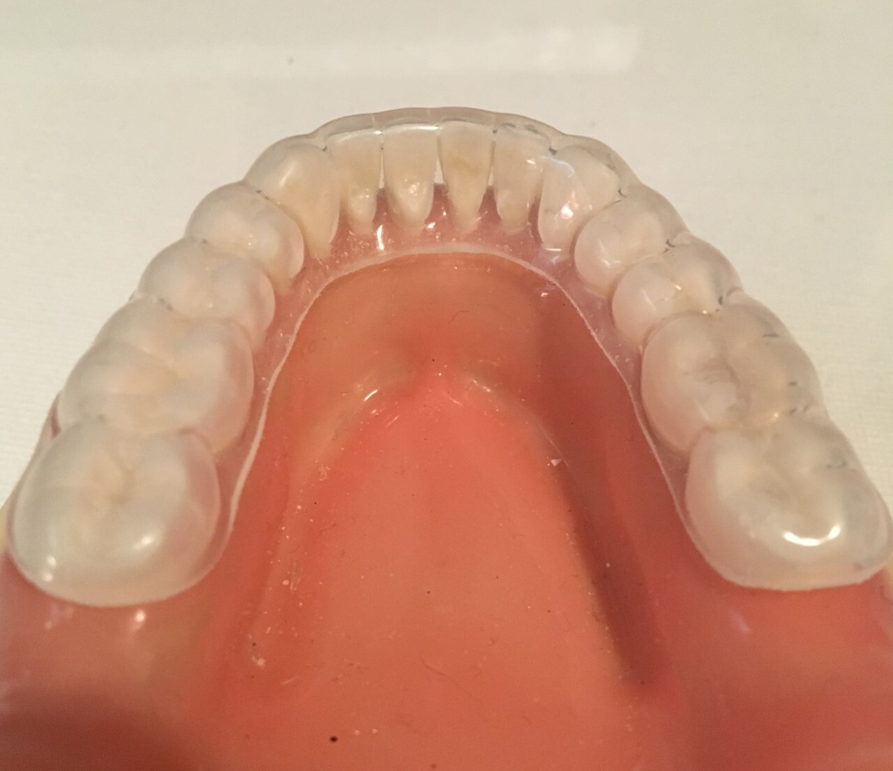 Custom Dental Retainers Upper And Lower- Aligner Type Made by USA Dental Lab