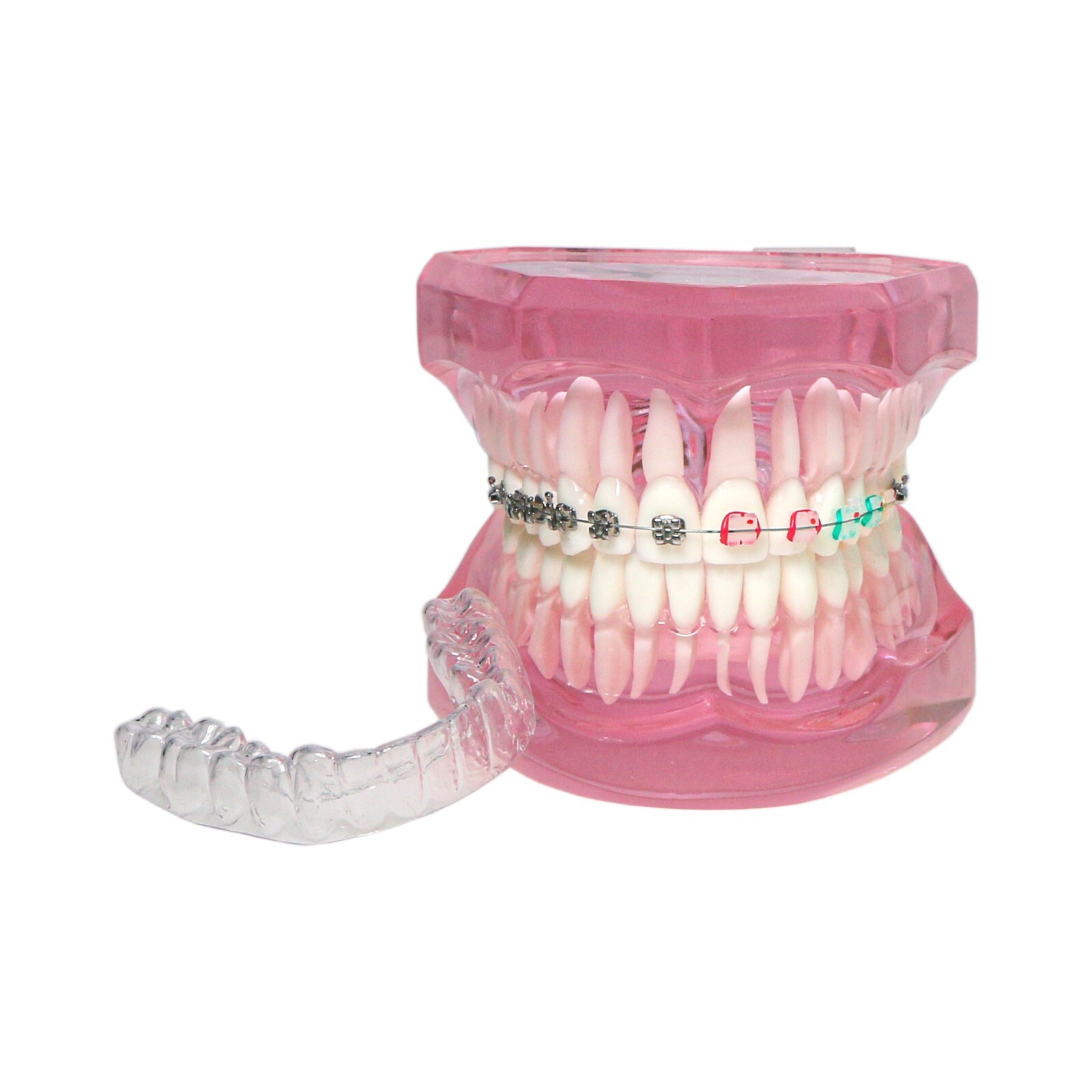 Dental Ortho Teeth Model With Metal Ceramic Brackets Lingual Braces Tube Teach