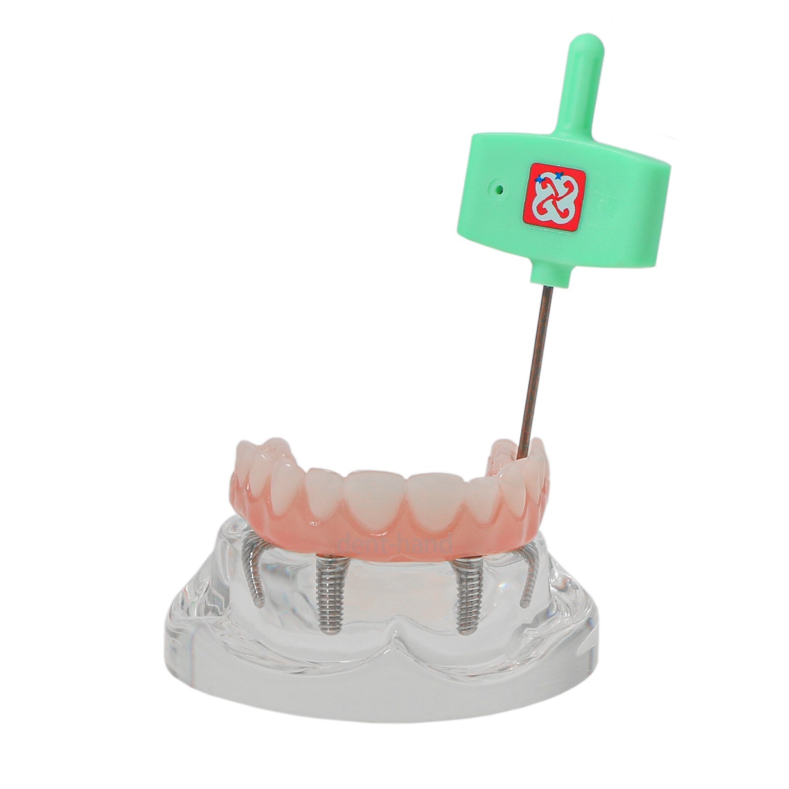 Dental Upper/Lower 4 Implants Demo Implant Teeth Model Restoration Overdenture