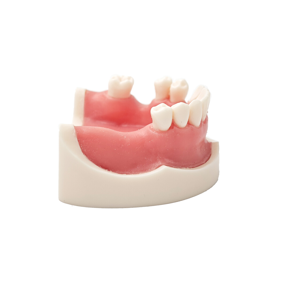 US Dental Model Implant Practice Model For Dentistry Teaching Study Soft Gums