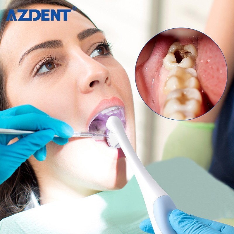 Dental HD USB Intraoral Camera Imaging Intra Oral Endoscope 8 LED 1440P