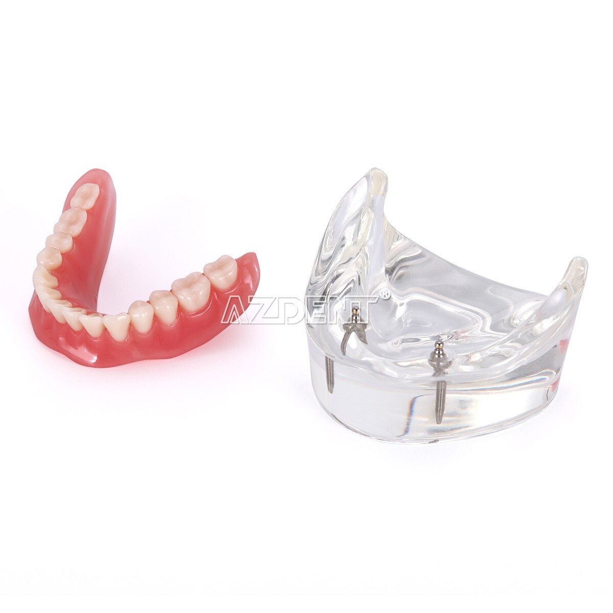 Dental Implant Teeth Model Demo Overdenture Restoration With Implants Lower