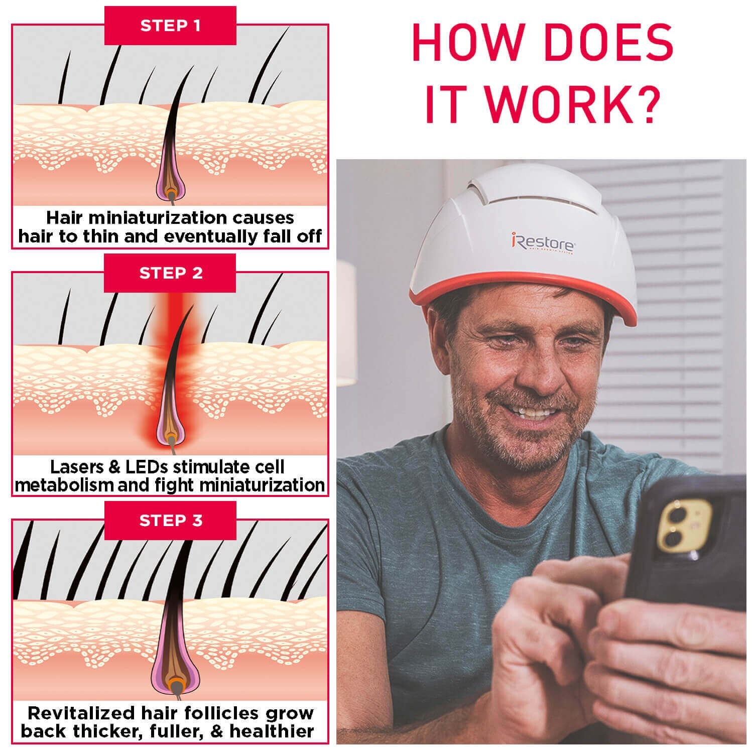 iRESTORE Professional 282 Laser Hair Growth System - Reconditioned