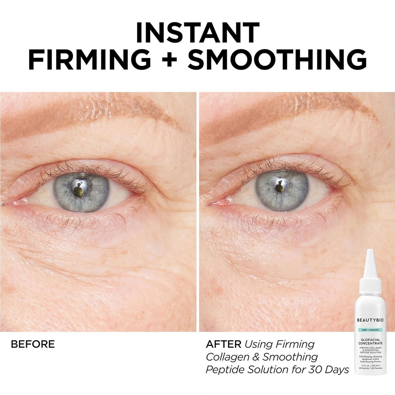 BeautyBio GLOfacial Hydro-Infusion Deep Pore Cleansing With Blue LED - Green -