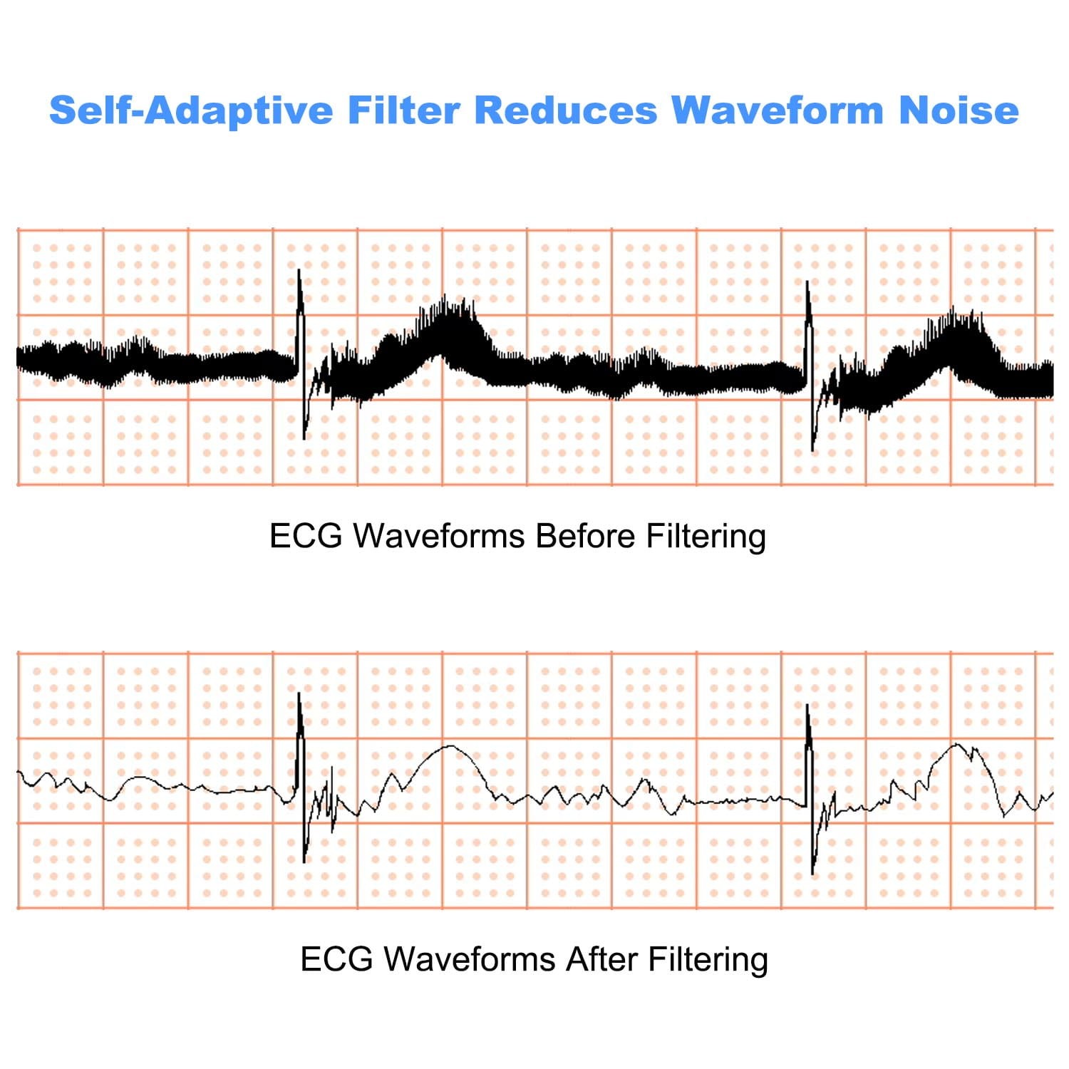 Professional Portable 12-Lead EKG Machine 3-Channel ECG with Analysis & Printer