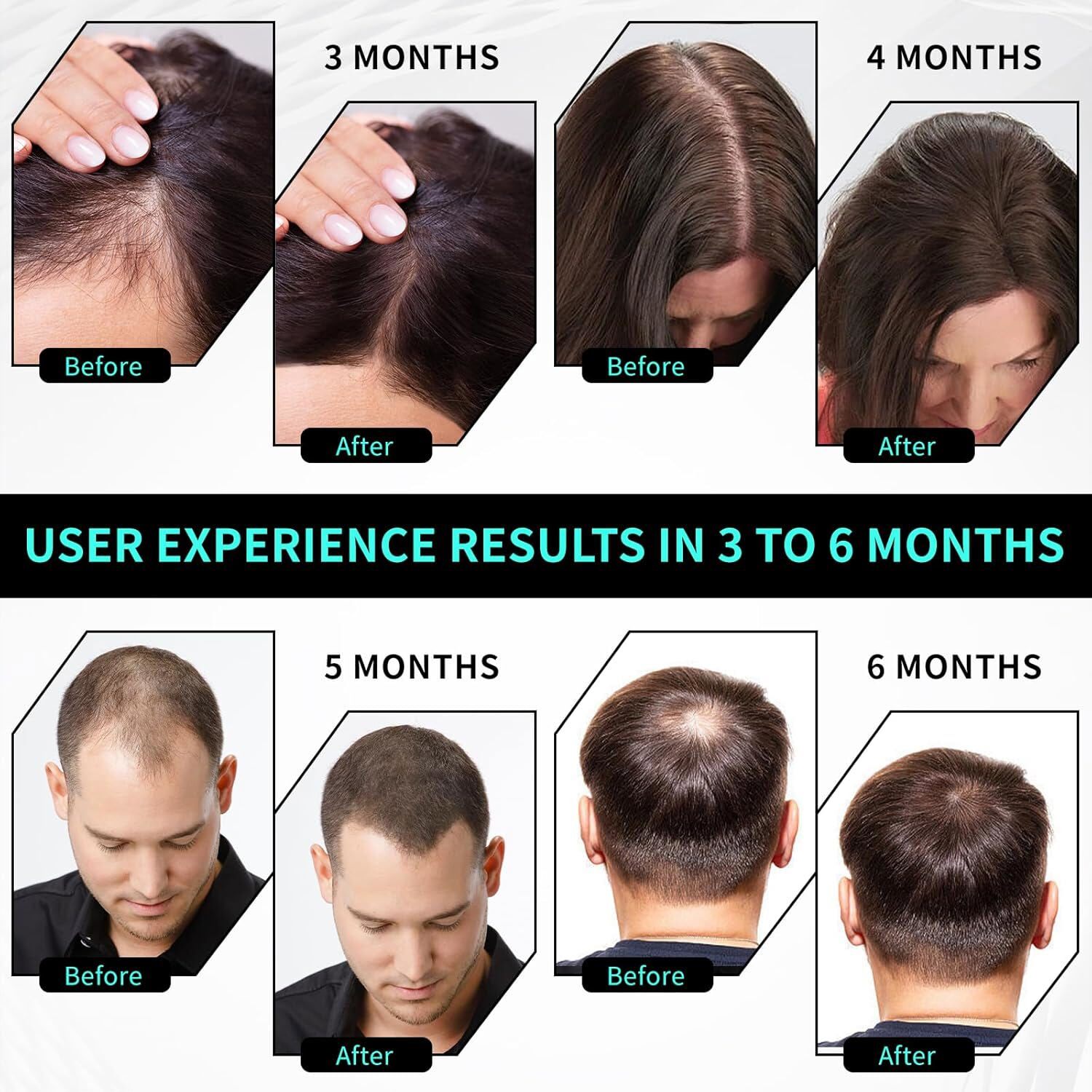 650nmLaser Red Light Therapy Hat Hair Loss Treatment Cap Hair Growth Regrowth US