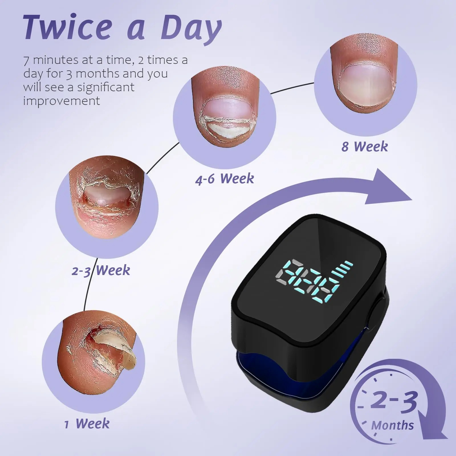 Nail Fungus Treatment Toe Nails Toenail Fungus Remover Toenail Laser Device