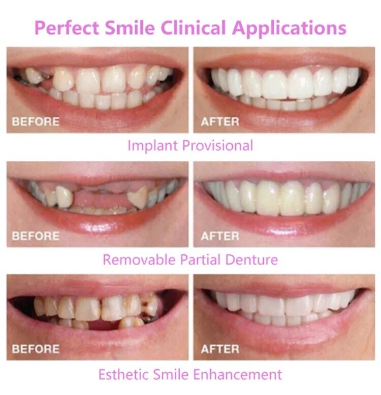 SnapOn Upper Lower False Teeth Dental Veneers Dentures Fake Tooth Cover Set USA