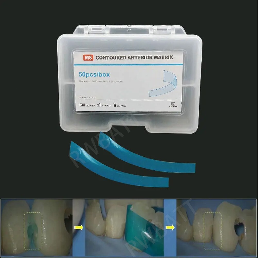Dental Contoured Anterior Matrix Bands Polyester Anterior Strips Matrices System