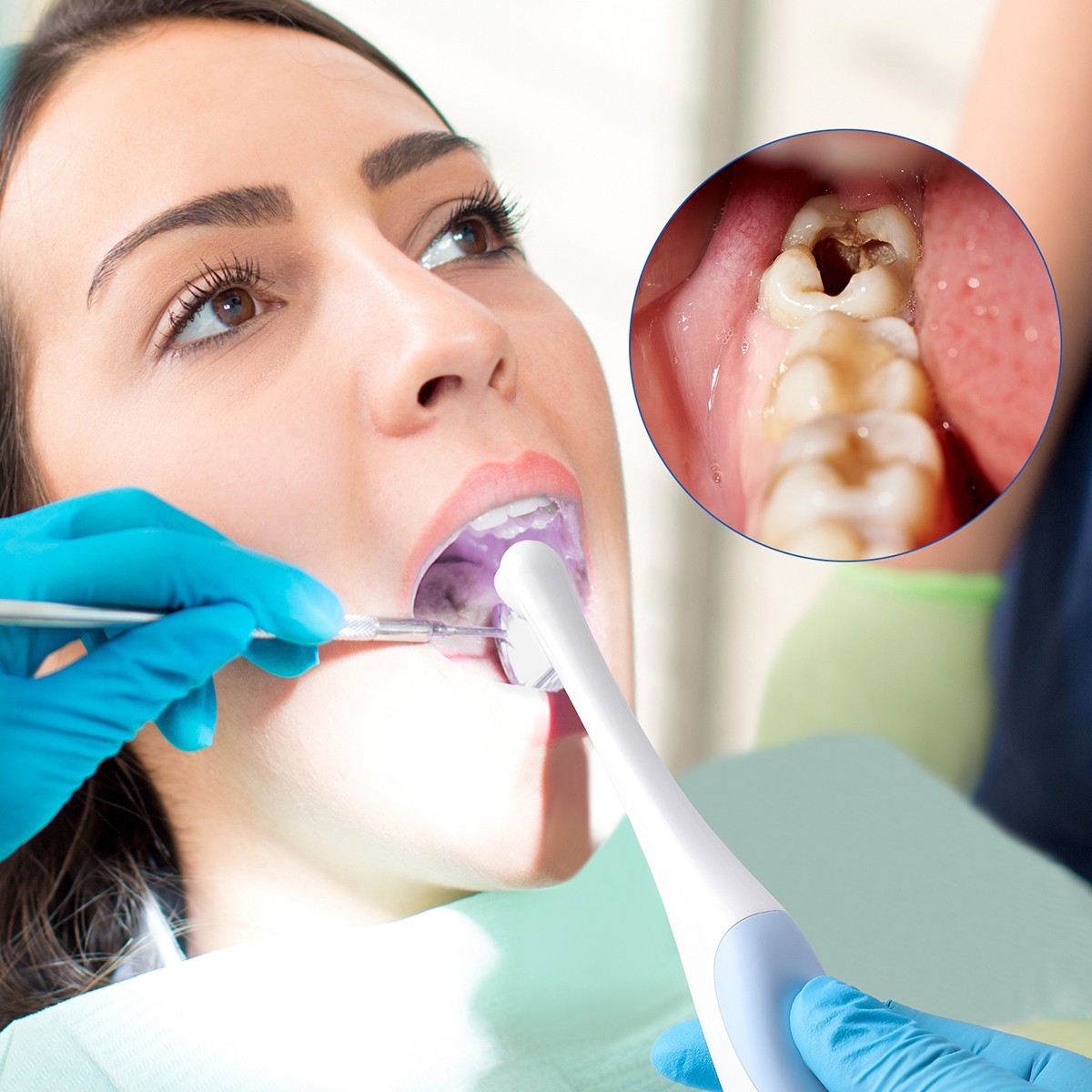 Dental Oral Endoscope USB Intraoral Camera 8 LED light Apple&Type-C 1M cable