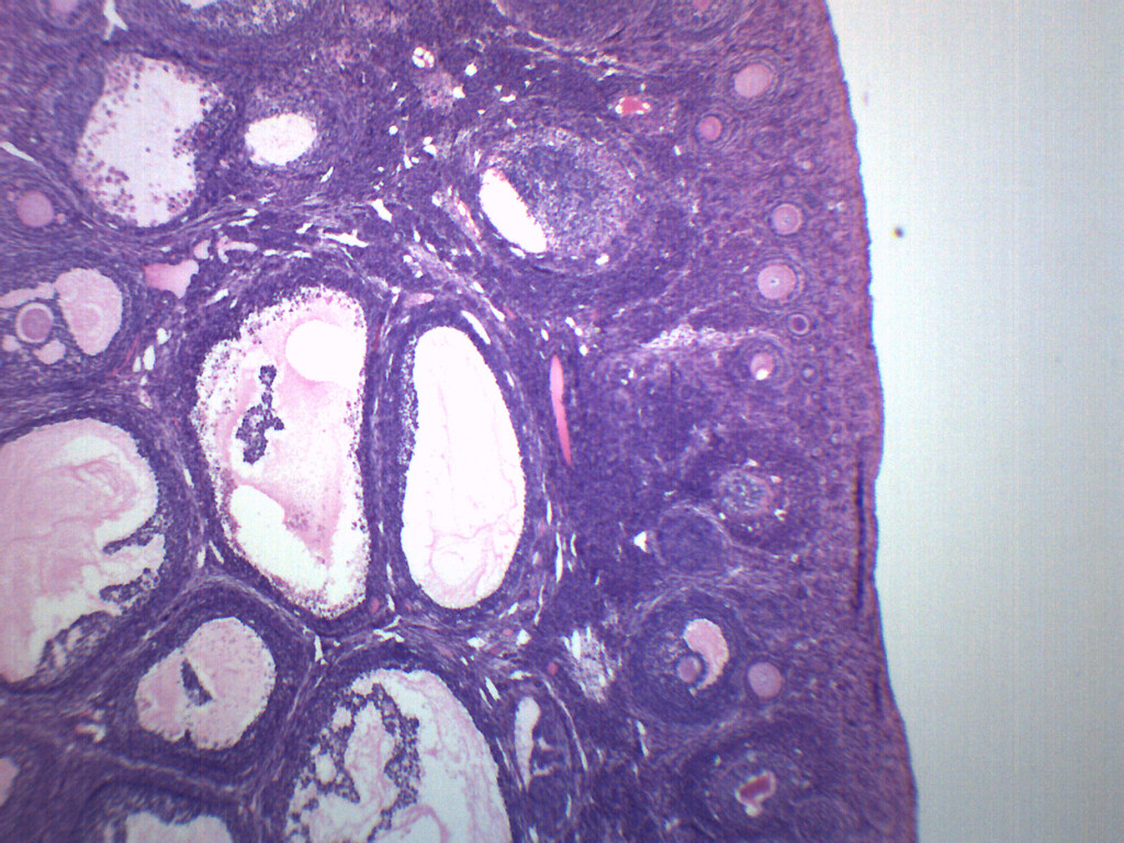 Female Ovary - Prepared Microscope Slide - 75x25mm - Eisco Labs