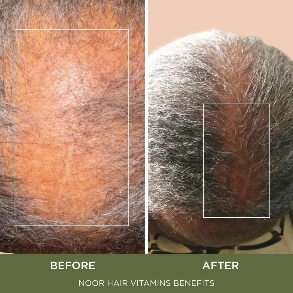 NOOR HAIR Healthy Hair Formula, Hair Growth Supplement Supporting Thick Hair