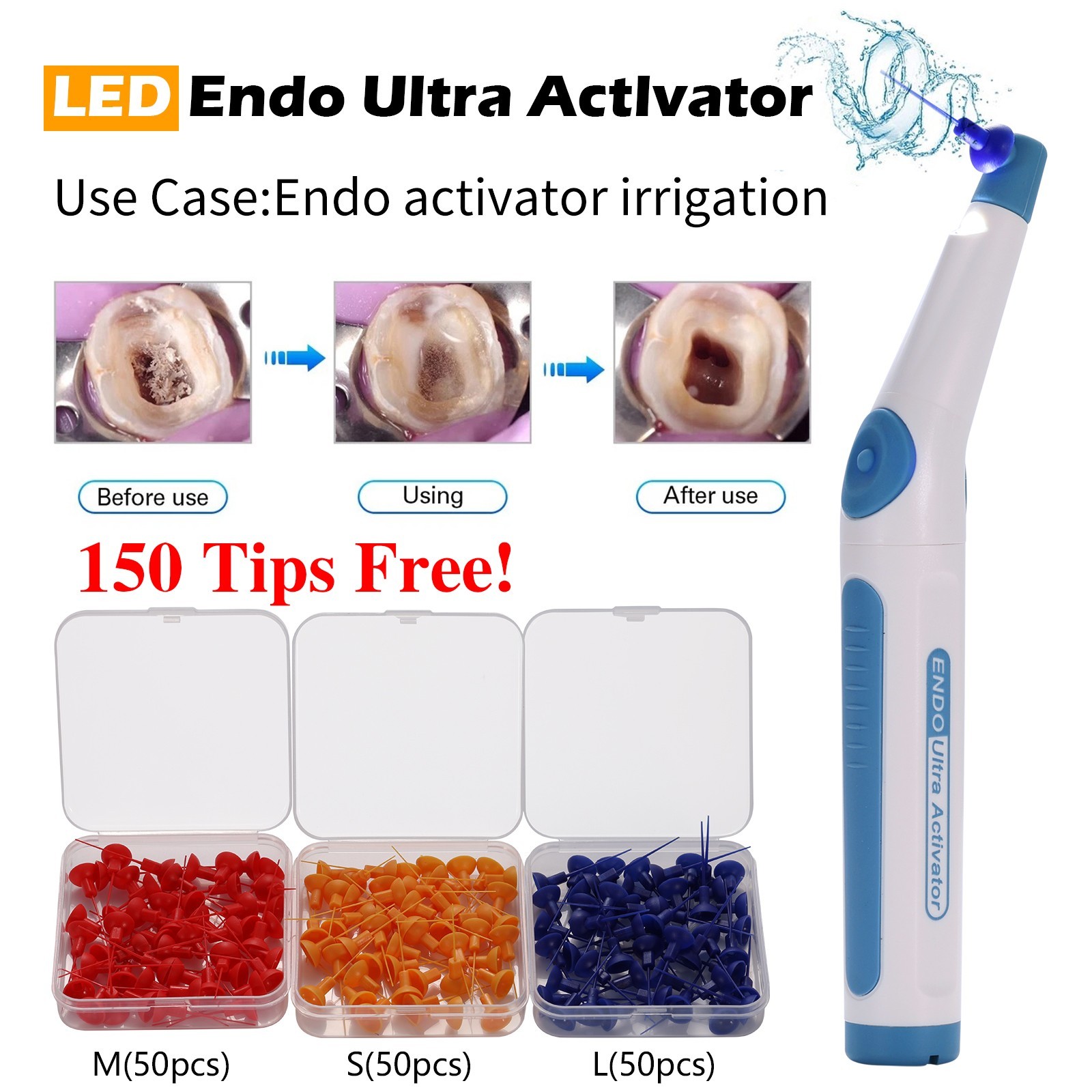 Dental Endodontic Endo Activator Sonic Endo Ultra Irrigator Root Canal +150 Tips