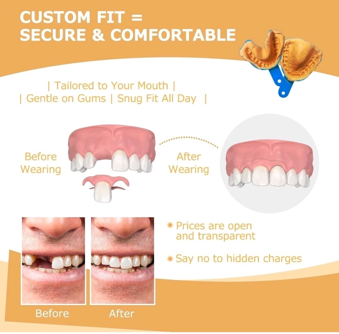 Partial Dentures - Dentures for Missing Teeth & Gaps - Lightweight & Unbreaka...