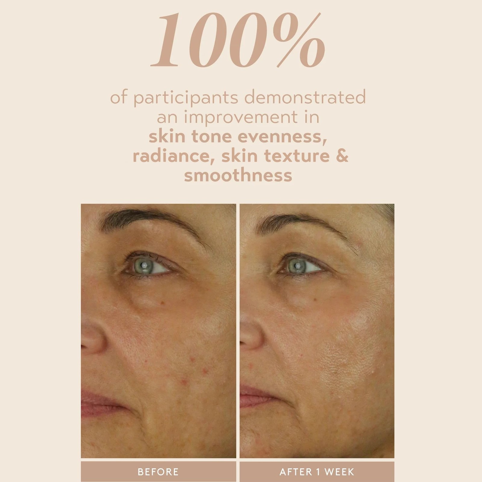 SHANI DARDEN SKIN CARE Retinol Reform with 1% Encapsulated Retinol Serum for Fac