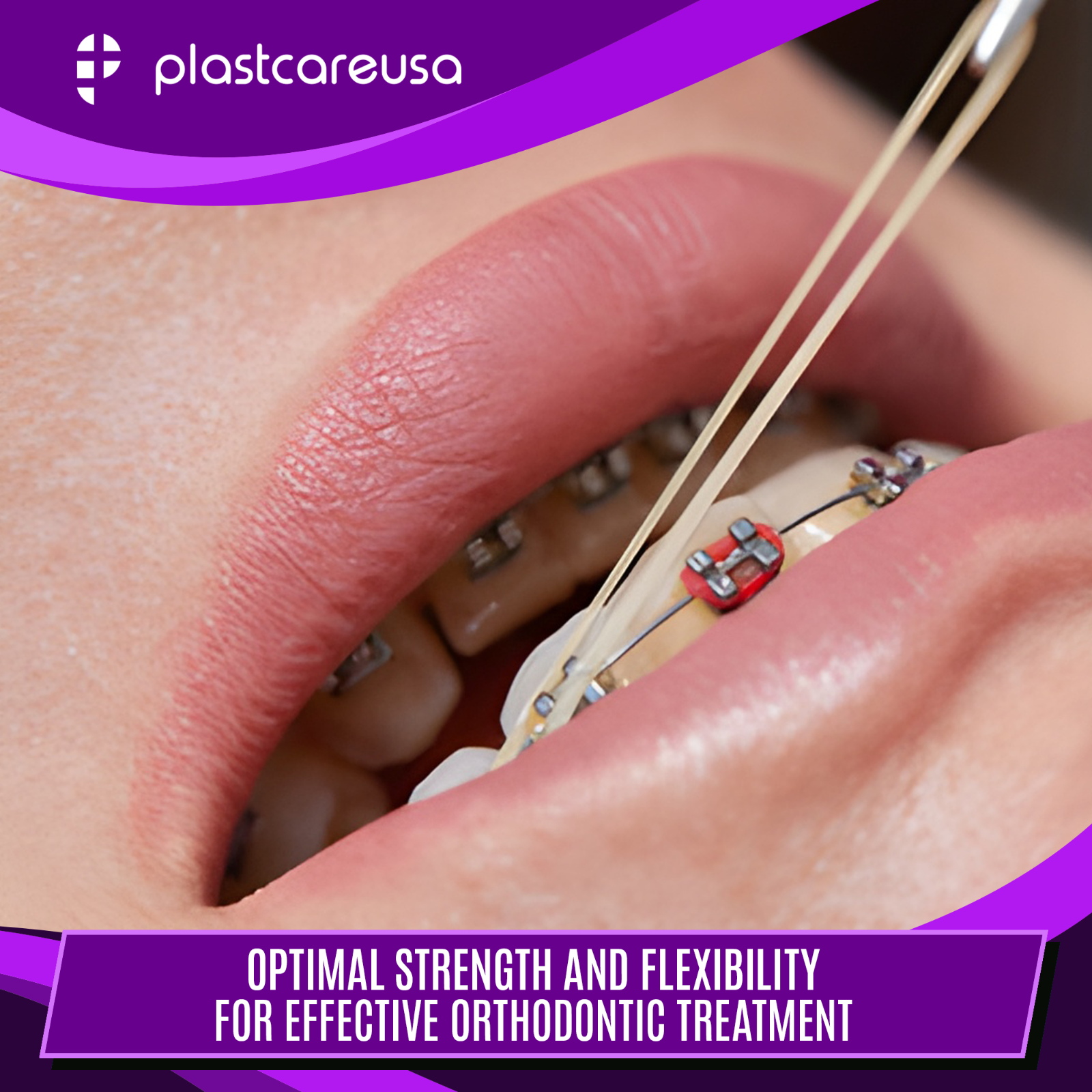 100 Assorted Color Light 3.5 Oz 3/16" Rabbit Latex Elastic Rubber Bands Braces