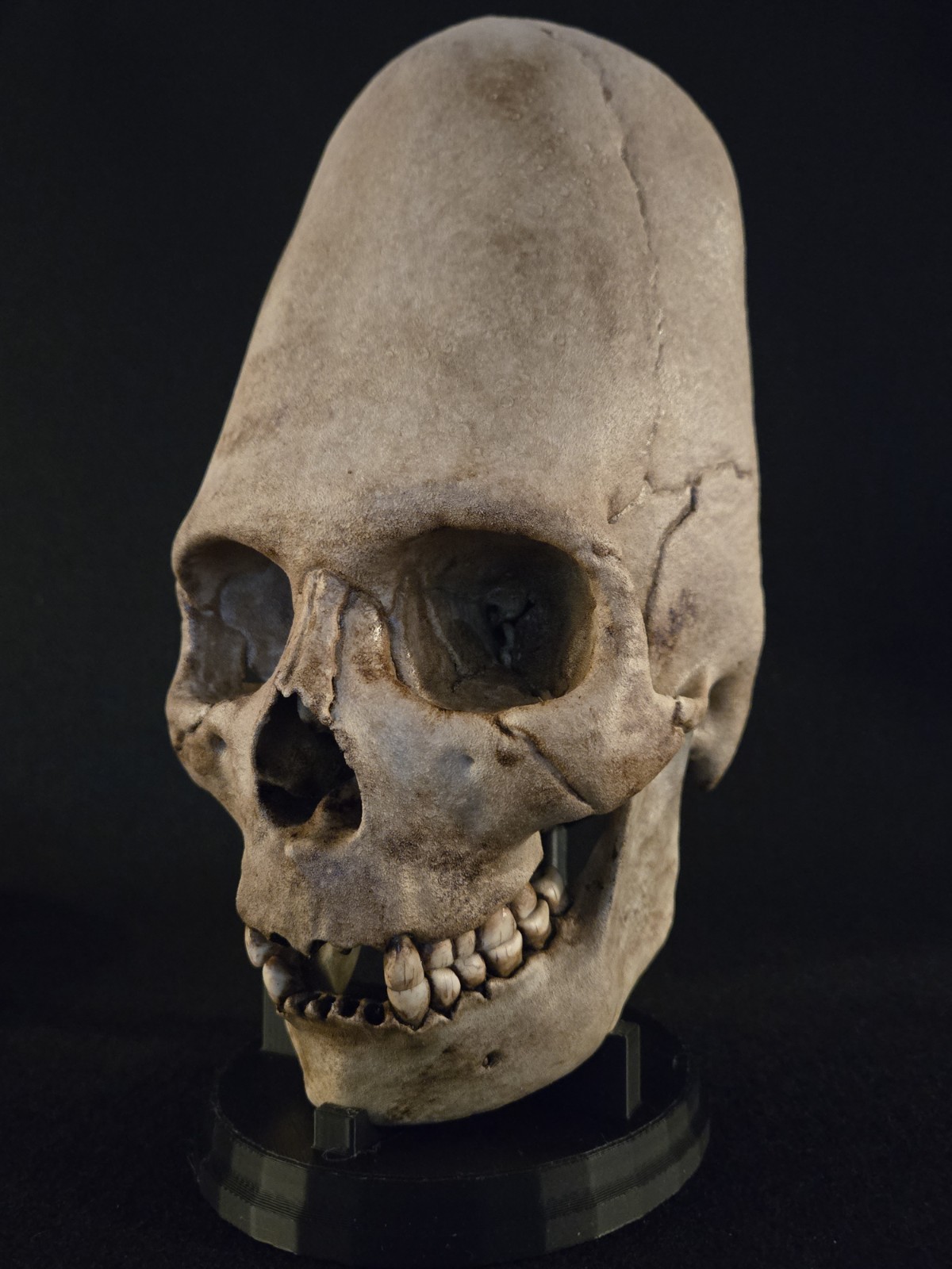 Human Skull - Peruvian Enlongated- Hyper Realistic with stand.