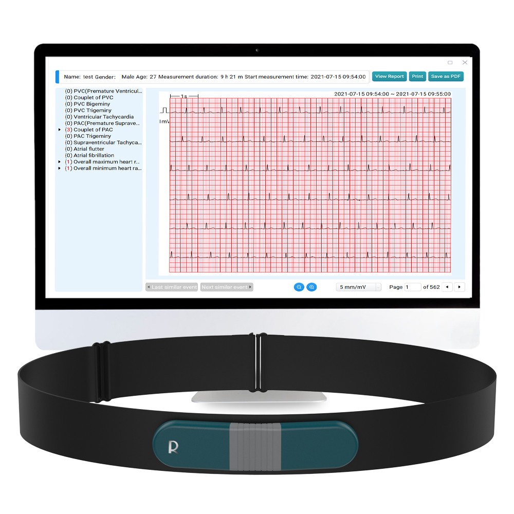 Holter Monitor 24 hours EKG Monitor ECG Recording PC Software Free AI Analysis