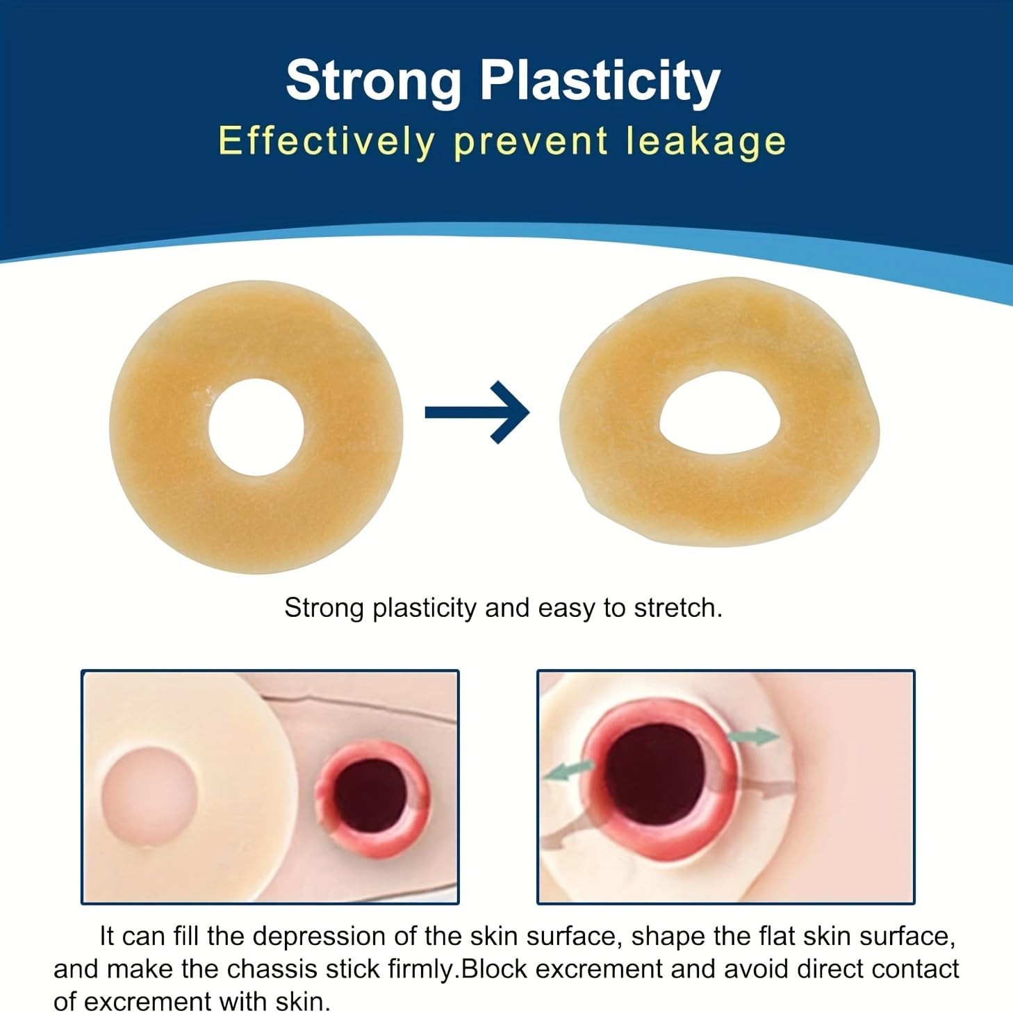 10 PCS Ostomy Barrier Rings, 2Mm Thickness Moldable Colostomy Rings, Medical Gra