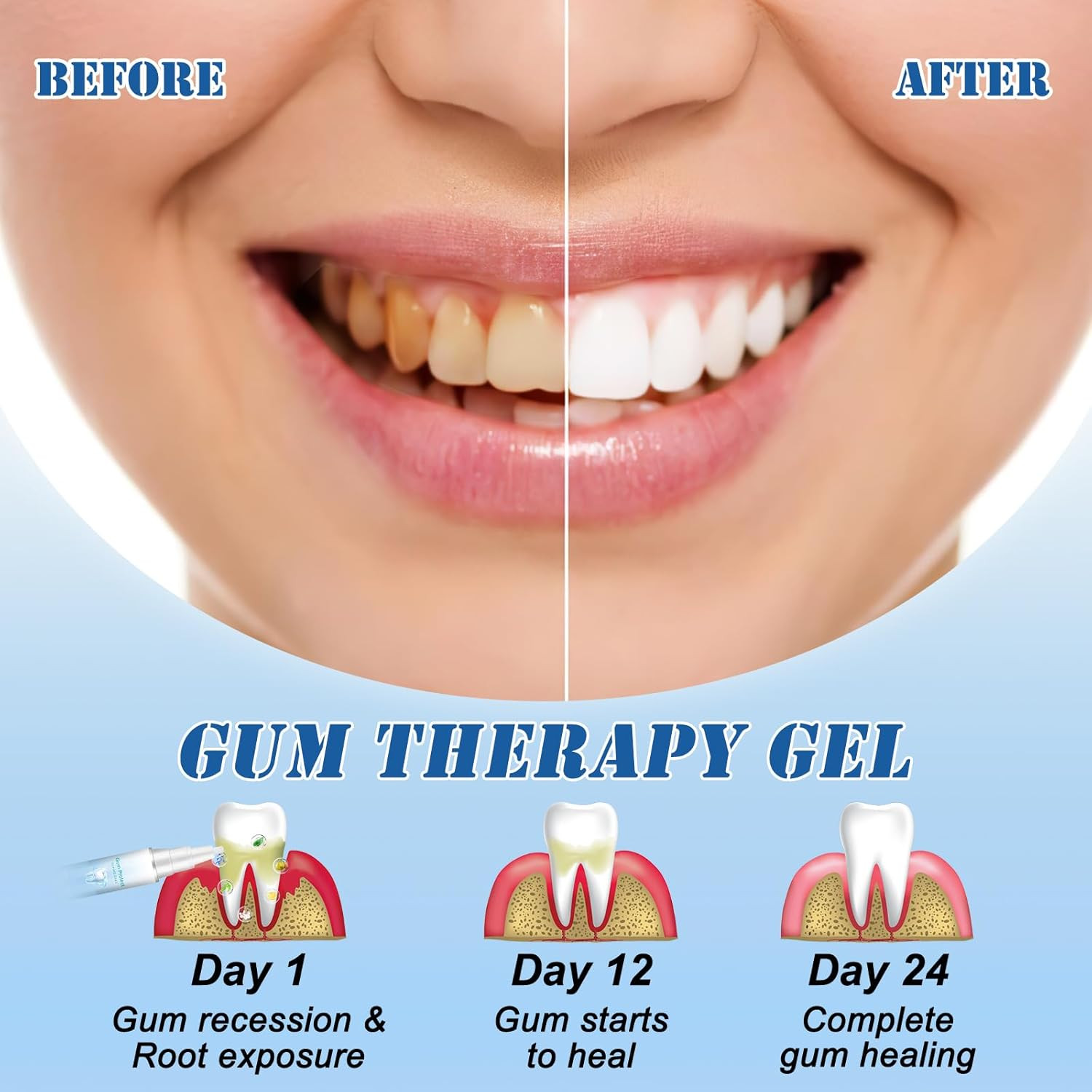 Neslemy™ Gum Shield Therapy Gel, Neslemy Gum Gel, Dentizen Gum Therapy Gel, Teet