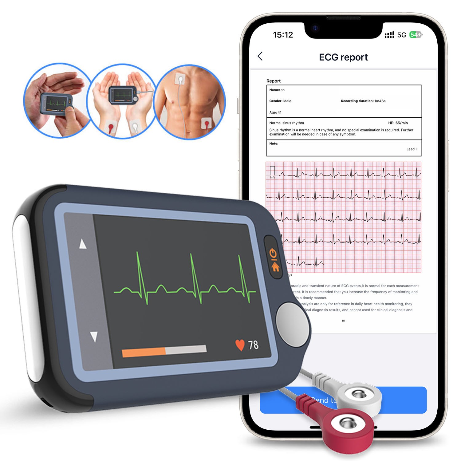 2025 New EKG Monitor Bluetooth Heart Monitor 30s/60s/5min Recording+AI Analysis