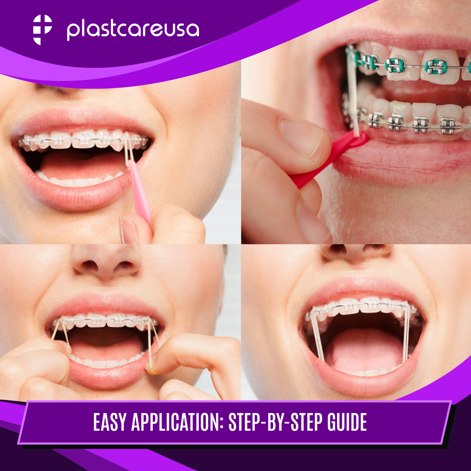 100 Assorted Color Light 3.5 Oz 3/16" Rabbit Latex Elastic Rubber Bands Braces