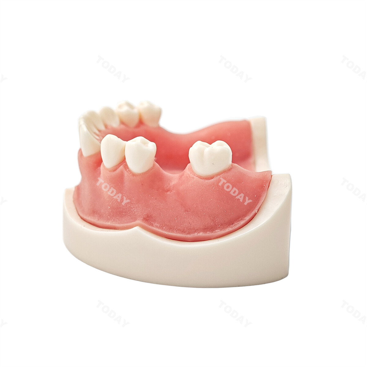 US Dental Model Implant Practice Model For Dentistry Teaching Study Soft Gums