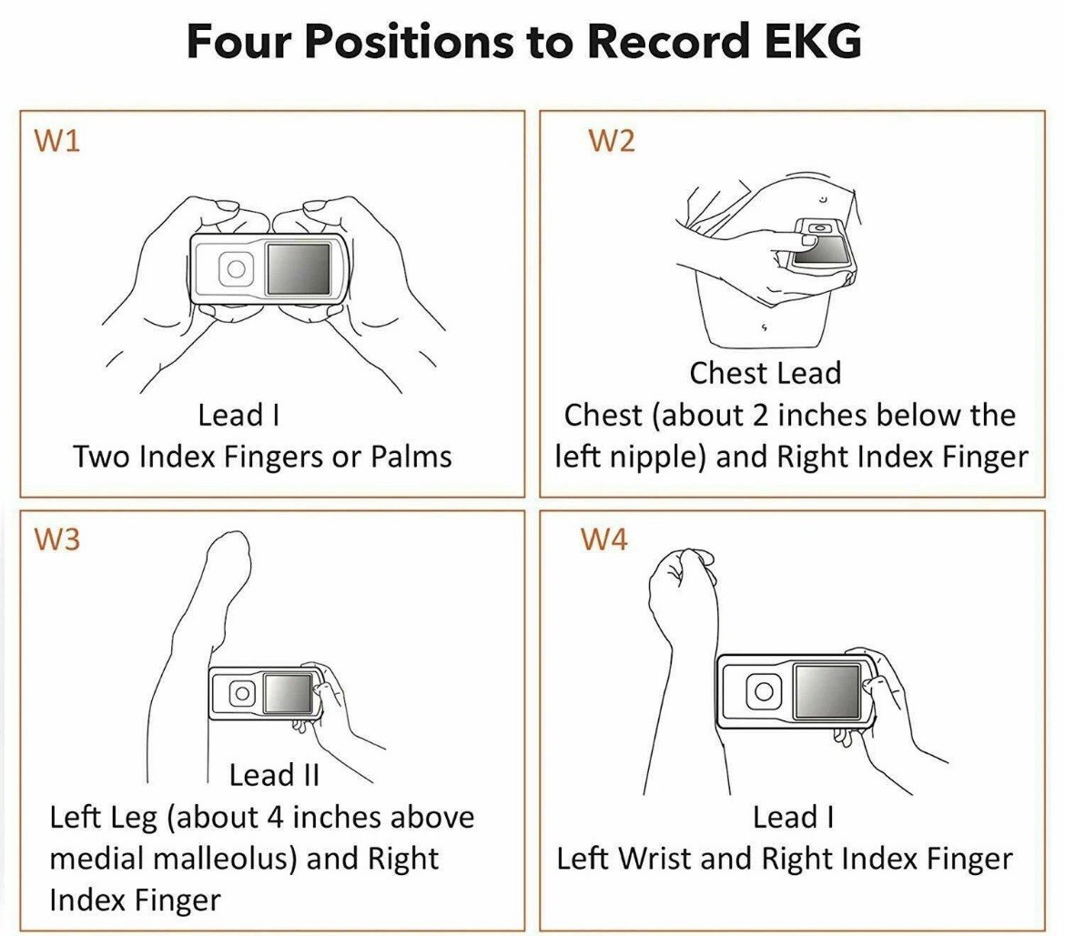 EMAY Bluetooth Portable ECG/EKG Monitor For iPhone & Android mac & Windows EMG20